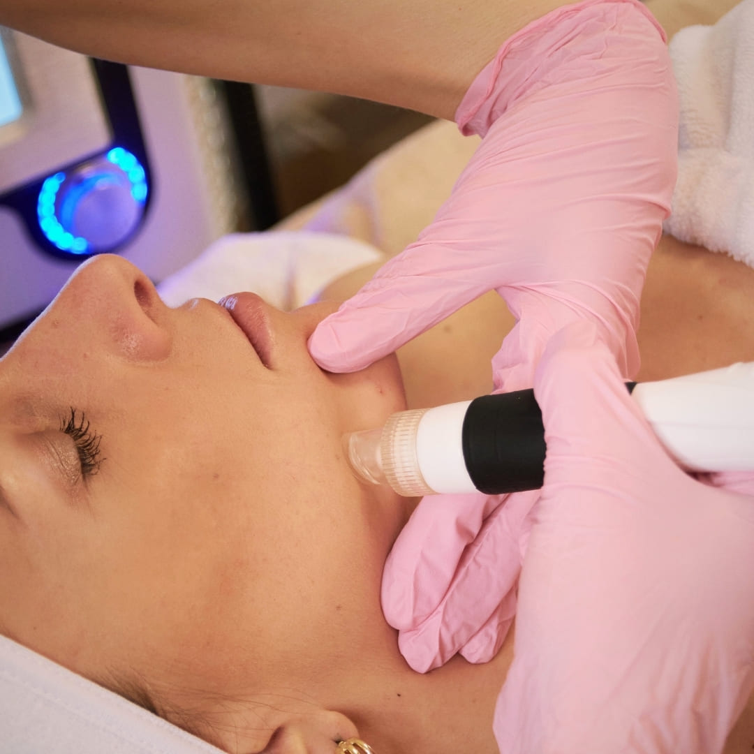 Lézeres szőrtelenítés & arckezelések – Bliss Laser & Beauty Budapest