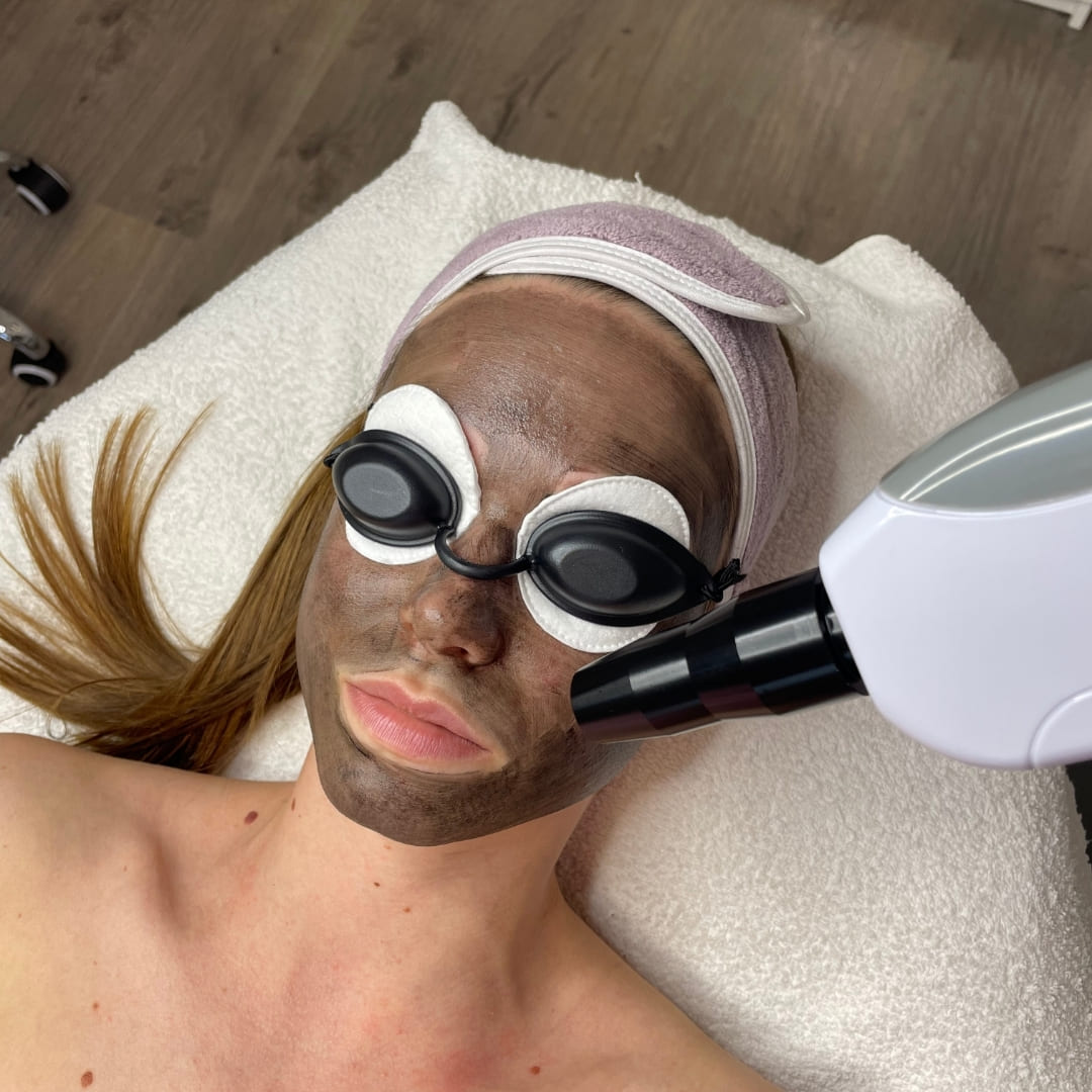 Lézeres szőrtelenítés & arckezelések – Bliss Laser & Beauty Budapest