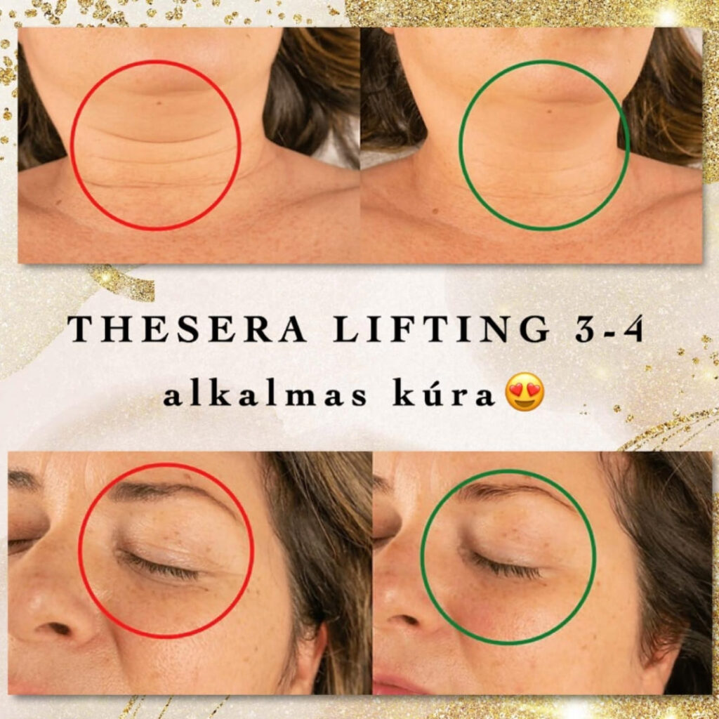 Lézeres szőrtelenítés & arckezelések – Bliss Laser & Beauty Budapest