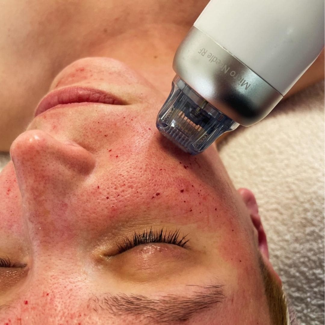 Lézeres szőrtelenítés & arckezelések – Bliss Laser & Beauty Budapest